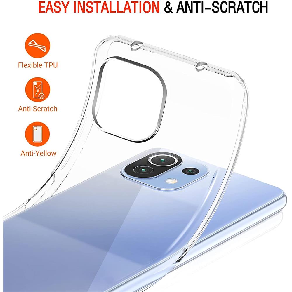 Zero für Xiaomi Mi 11 Lite in Transparent