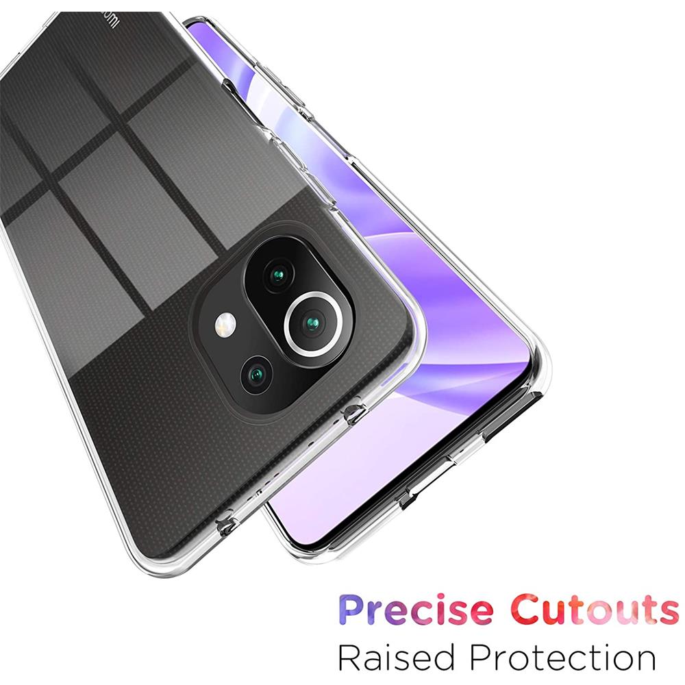 Zero für Xiaomi Mi 11 Lite in Transparent